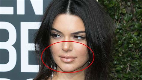 5 Celebs You Didnt Know Struggle With Acne Shefinds
