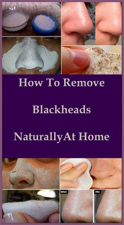 the way to eliminate black spots on face in a single day brownspotsonface blackheads on nose
