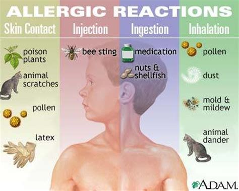 Anaphylaxis What You Need To Know About Life Or Death Allergic