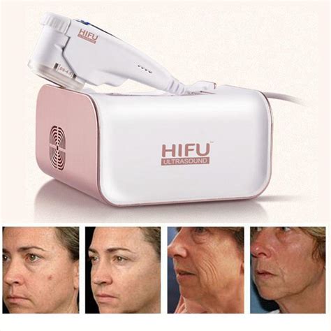 New Portable Professional Hifu Wrinkle Removal Rf Led Face Lifting High Intensity Focused