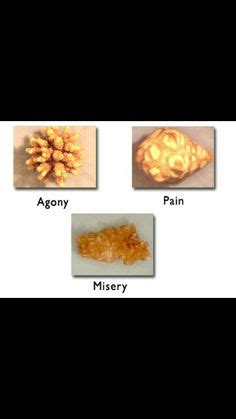 Doctors use these to check for stones in your urinary tract. 28 Best Kidney Humor images | Humor, Nurse humor, Medical humor