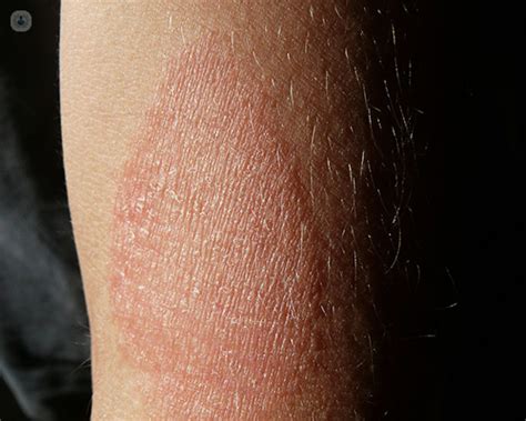 What Causes A Skin Rash Top Doctors