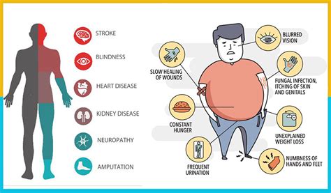Top 8 Symptoms Of Type 2 Diabetes Diabetes Treatment Guide Diabetes Symptoms Natural Cure