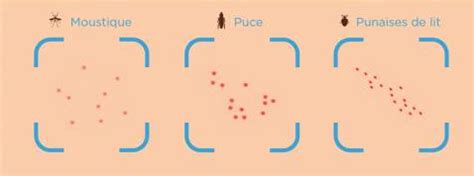 En piquant, la punaise de lit injecte un anesthésiant. Piqûre de punaise de Lit - Extermination punaises de lit