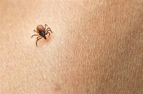 Everything You Never Wanted To Know About How Ticks Hunt You And How