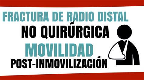 Tratamiento Fractura Distal Radio No Quirúrgica Movilidad Post