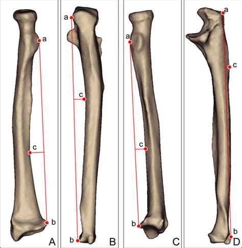 Blank Ulna Diagram