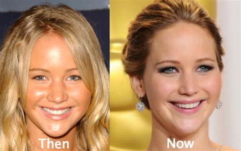 Jennifer Lawrence Plastic Surgery Before And After Photos