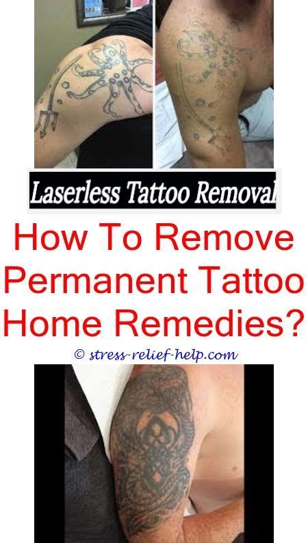 If you're just starting laser removal, you're probably wondering how long recovery will take between sessions. How much does it cost to remove a tattoo.Post tattoo ...