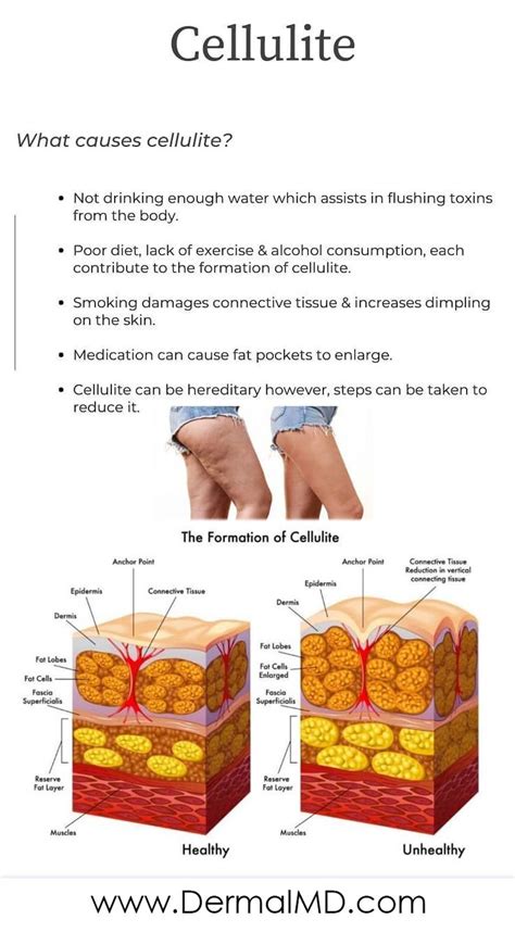 Pin On What Causes Cellulitis