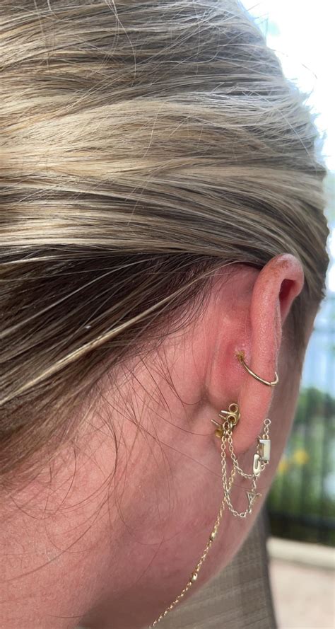 Does My Conch Piercing Look Infected Rpiercingadvice