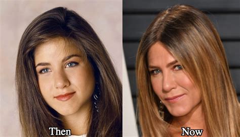 Jennifer Aniston Plastic Surgery Before And After Photos