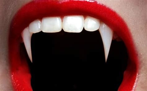 Top 9 How Much Do Vampire Fangs Cost The 170 New Answer