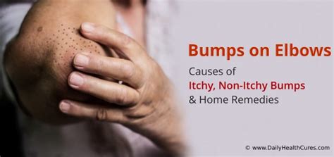 Bumps On Elbows Causes Of Itchy And Non Itchy Bumps