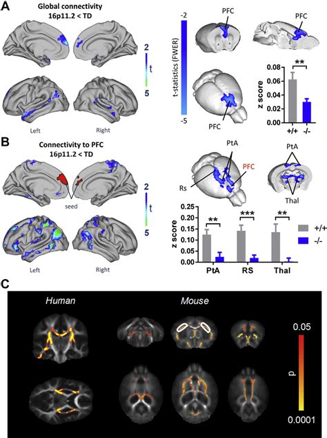autism associated 16p11 2 microdeletion similarly impacts functional download scientific