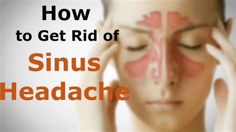 Sinus Headache Causes Symptoms Relief And Treatment