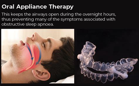 A Dentist Can Help With Sleep Apnoea Treatment New Road Dental In