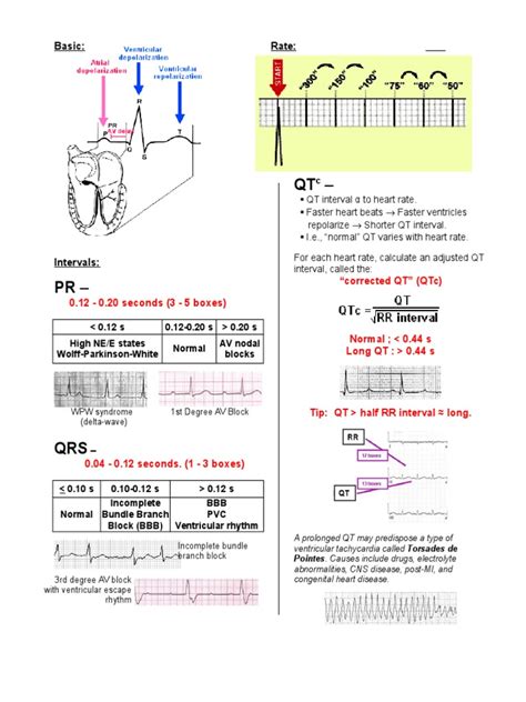 18811210 A Simplified Ecg Guide Cardiac Arrhythmia Electrocardiography