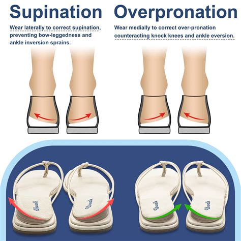 Supination Shoe Wear Pattern