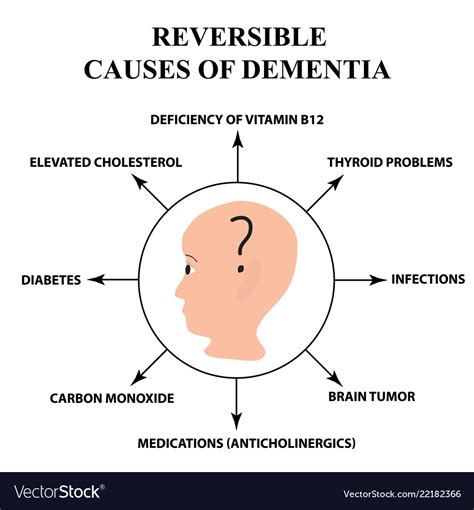 Reversible Causes Senile Dementia Alzheimers Vector Image