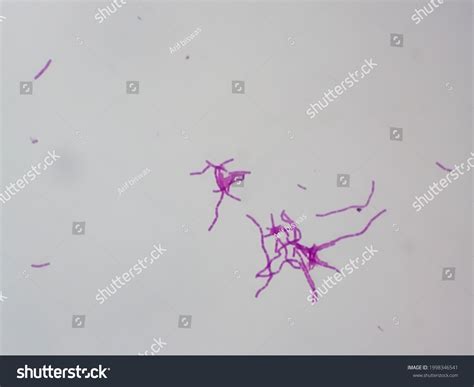 Streptococcus Pyogenes Gram Positive Cocci Microscopic ภาพสต็อก