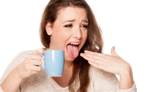 Home Remedies For Tongue Burn That Works