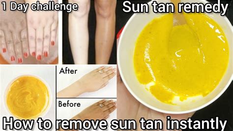 Diy Sun Tan Removal Home Remedieshow To Remove Sun Tan Instantly1 Day