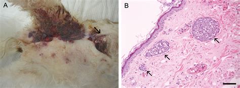 Inflammatory Mammary Carcinoma With Metastasis To The Brain And Distant