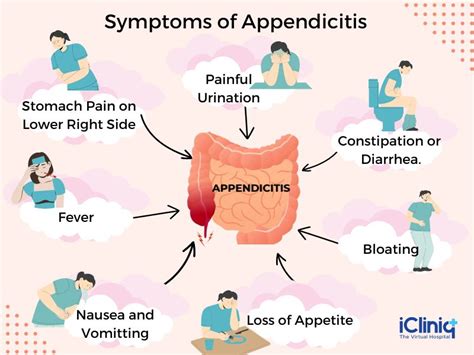 11 Common Symptoms Signs Of Appendicitis New Life Tic