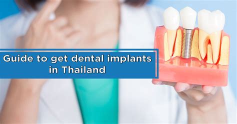 Guide To Get Dental Implants In Thailand Bfc Dental