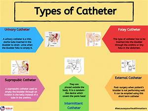Types Of Catheter