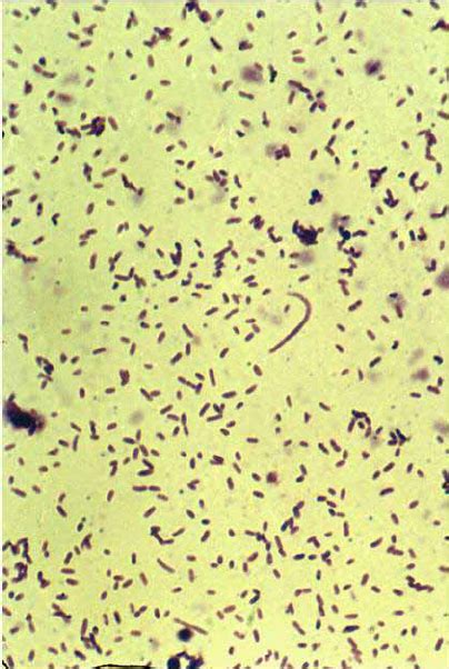 A Smear From Cultured Corynebacterium Show Ing Bacilli In A Typical