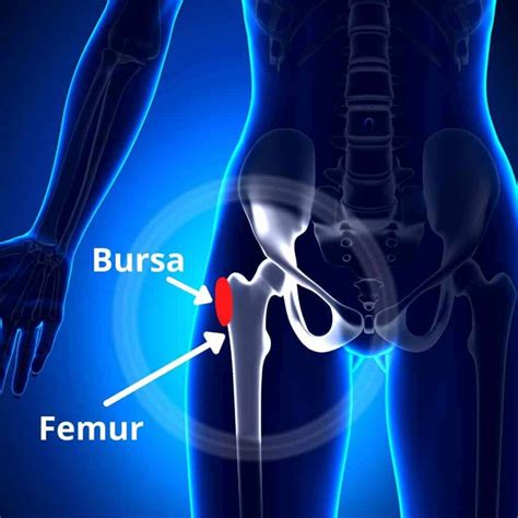 Hip Bursitis Exercises For Pain Relief Pt Time With Tim