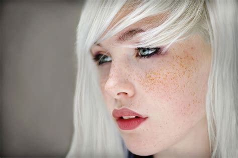 White Hair Freckles And Gorgeous Eyes Gorgeous Eyes Freckles Girl