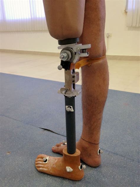 A Cheaper High Performance Prosthetic Knee Mit News Massachusetts