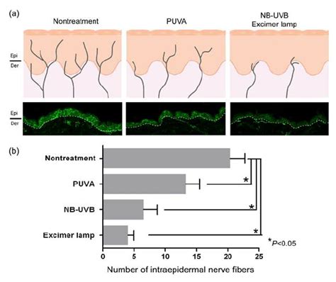 effects of uv based therapy on intraepidermal nerve fibers in download scientific diagram
