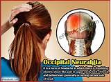 Left Side Pain Headache Causes Images