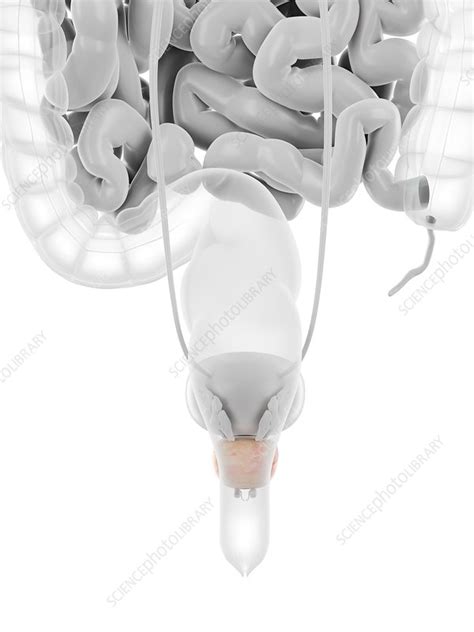 Prostate Illustration Stock Image F0294535 Science Photo Library