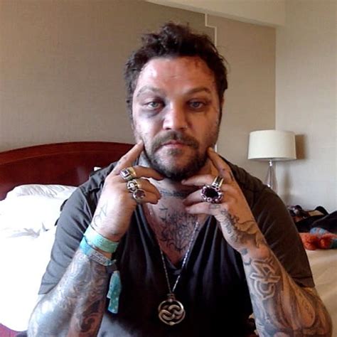 Bam Margera Gets Into Fight With Icelandic Rappers Shares Brutal Pics