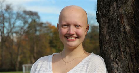 Living With Alopecia A Young Womans Path To Self Acceptance Pfizer