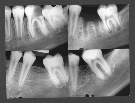 27 Managing The Developing Occlusion Pocket Dentistry