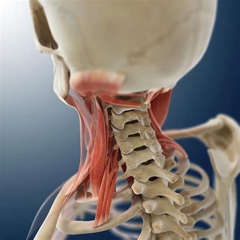 Neck Muscles Photograph By Springer Medizinscience Photo Library