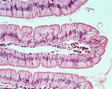 Small Intestine Histology