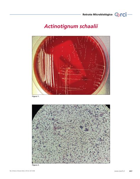 Pdf Actinotignum Schaalii