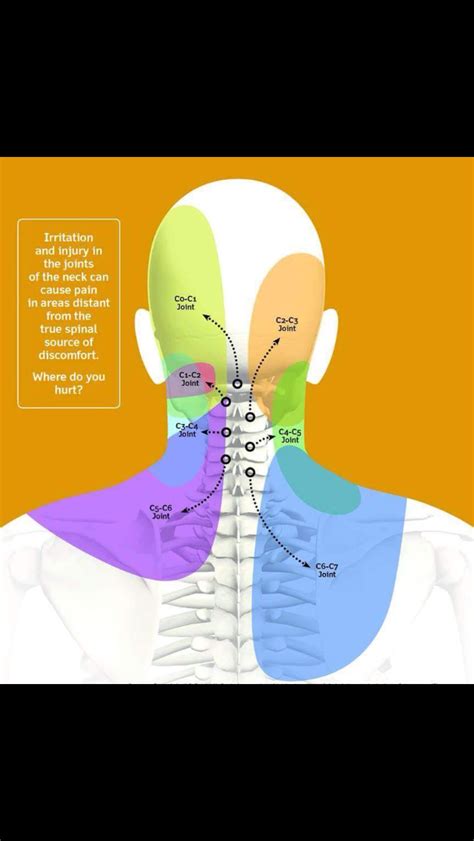 Occipital Nerve Block Injections For Occipital Neuralgia Migraines