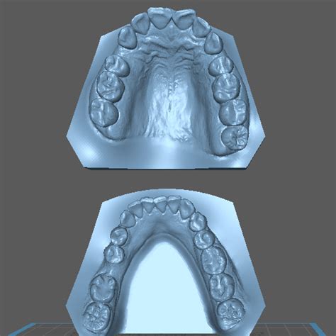 Stl File Dental Model Dental Model・3d Printer Design To Download・cults