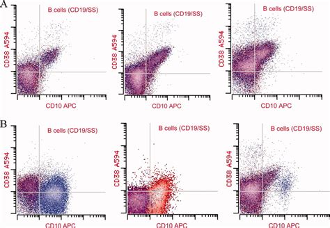 Flow Cytometric Evaluation Of Cd38 Expression Assists In Distinguishing