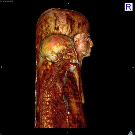The Mummy Unmasked Medical Scans Give Amazing Images Of Ancient