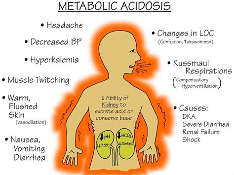 Hyperchloremic Acidosis Definition Causes Symptoms Diagnosis Treatment