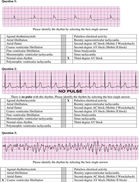 Acls Test Answers 2017 Pdf Resume Examples